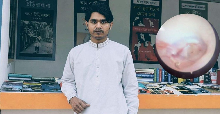 ছাত্রদলের হামলা: ঢাবির হল সংসদ নেতার কানের পর্দা ফেটে গুরুতর আহত